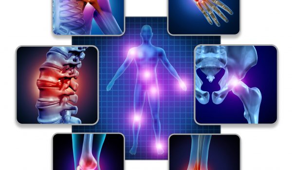 Human body joint pain concept as skeleton and muscle anatomy of the body with a group of sore joints as a painful injury or arthritis illness symbol for health care and medical symptoms with 3D illustration elements.